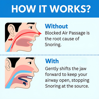 Universal Anti-Snoring Mouthpiece - Adjustable Comfort Fit for Better Sleep 😴