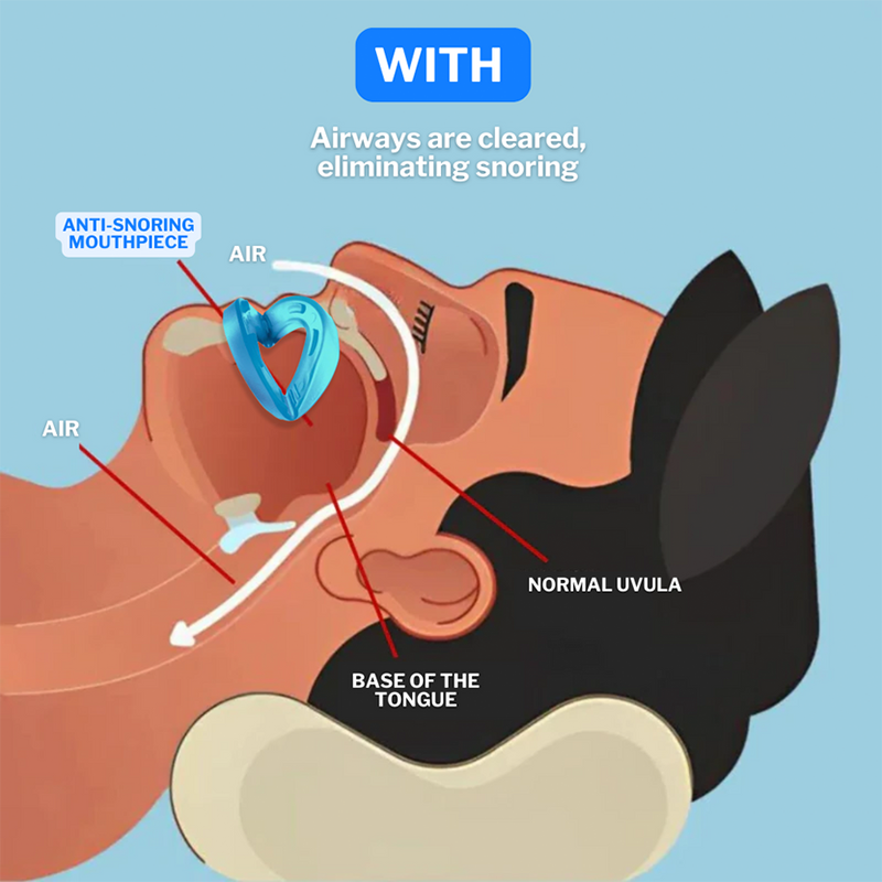 Universal Anti-Snoring Mouthpiece - Adjustable Comfort Fit for Better Sleep 😴