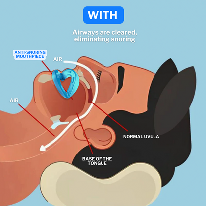 Universal Anti-Snoring Mouthpiece - Adjustable Comfort Fit for Better Sleep 😴