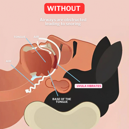 Universal Anti-Snoring Mouthpiece - Adjustable Comfort Fit for Better Sleep 😴