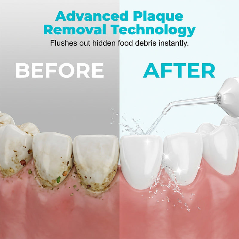 Portable Cordless Water Flosser for Teeth